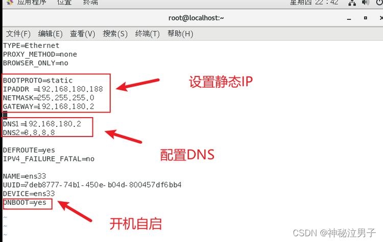 静态IP设置参数详解插图
